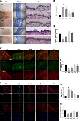 Luteolin Prevents UVB-Induced Skin Photoaging Damage by Modulating SIRT3/ROS/MAPK Signaling: An in vitro and in vivo Studies